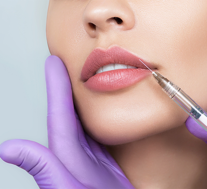 dermafiller-2